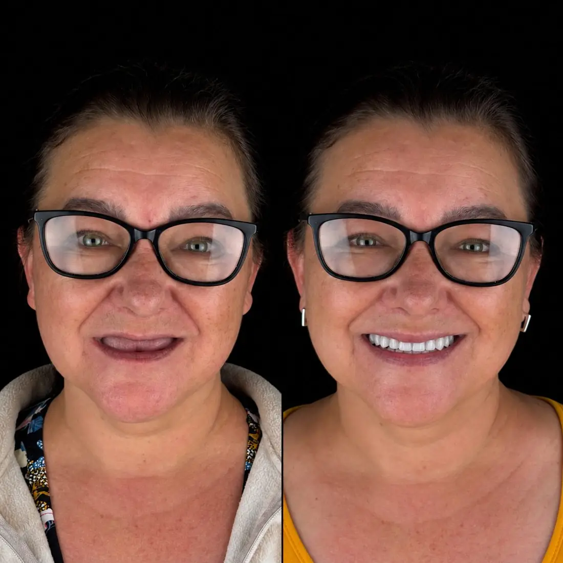 Caso real de reabilitação