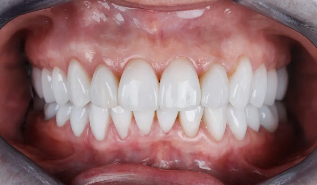 Estética do Sorriso