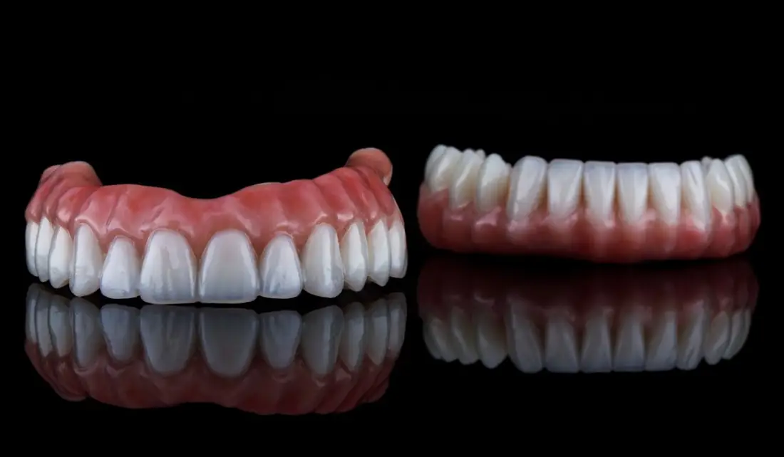 Prótese Protocolo ou Dentadura: Qual a Diferença?
